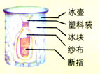 关于手外科断肢再植手术的临床的毕业论文格式范文